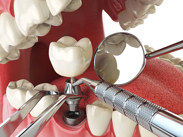 Reliable OR Emergency Dentist Solutions