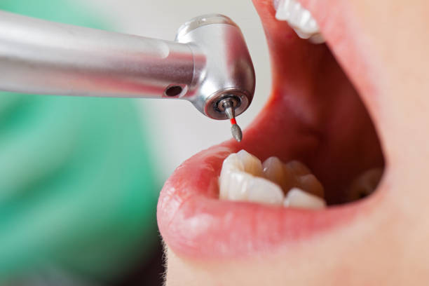 Emergency Dentist Open Today in OR
